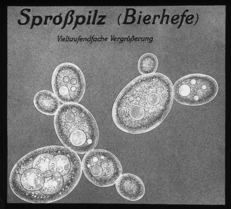 Sprosspilz (Bierhefe), vieltausendfache Vergrößerung. 
