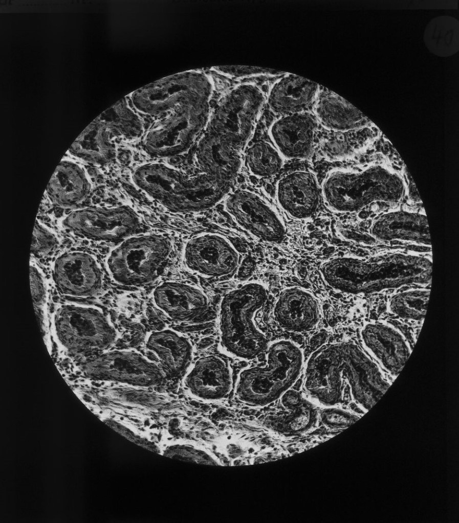 Querschnitt durch den Hoden bei einem gesunden 25jährigen Mann. (Nach einem mikr. Originalpräparat von Professor Weichselbaum.)